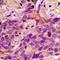 Acyl-CoA Synthetase Short Chain Family Member 1 antibody, orb318802, Biorbyt, Immunohistochemistry paraffin image 