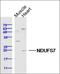 NADH:Ubiquinone Oxidoreductase Core Subunit S7 antibody, orb157939, Biorbyt, Western Blot image 