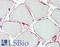 Peptidase Inhibitor 15 antibody, LS-B9555, Lifespan Biosciences, Immunohistochemistry paraffin image 