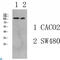 Collagen Type I Alpha 1 Chain antibody, LS-C813387, Lifespan Biosciences, Western Blot image 