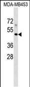 Major Histocompatibility Complex, Class I-Related antibody, PA5-48846, Invitrogen Antibodies, Western Blot image 