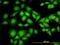 NME/NM23 Nucleoside Diphosphate Kinase 1 antibody, H00004830-M02, Novus Biologicals, Immunocytochemistry image 