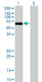 Bone Morphogenetic Protein Receptor Type 1A antibody, LS-C196762, Lifespan Biosciences, Western Blot image 