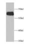 Aladin WD Repeat Nucleoporin antibody, FNab00275, FineTest, Western Blot image 