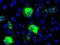 Sonic Hedgehog Signaling Molecule antibody, GTX83651, GeneTex, Immunofluorescence image 