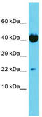 Trafficking Protein Particle Complex 6A antibody, TA330728, Origene, Western Blot image 