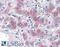 Phosphoenolpyruvate carboxylase antibody, 46-144, ProSci, Immunohistochemistry frozen image 