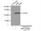 Adducin 2 antibody, 14640-1-AP, Proteintech Group, Immunoprecipitation image 