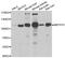 Membrane Bound Transcription Factor Peptidase, Site 1 antibody, abx005320, Abbexa, Western Blot image 