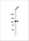 MER Proto-Oncogene, Tyrosine Kinase antibody, A00489-3, Boster Biological Technology, Western Blot image 