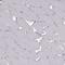 Tripeptidyl Peptidase 1 antibody, HPA044868, Atlas Antibodies, Immunohistochemistry paraffin image 