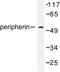 Peripherin antibody, AP06284PU-N, Origene, Western Blot image 