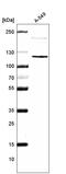 Cyclin Dependent Kinase Like 5 antibody, AMAb91323, Atlas Antibodies, Western Blot image 