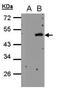 Cytohesin 4 antibody, PA5-28717, Invitrogen Antibodies, Western Blot image 