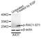 Rac Family Small GTPase 1 antibody, AP0086, ABclonal Technology, Western Blot image 