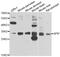 APAF1 Interacting Protein antibody, A09029, Boster Biological Technology, Western Blot image 