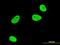 Serum/Glucocorticoid Regulated Kinase 1 antibody, orb94763, Biorbyt, Immunocytochemistry image 