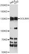 Golgi Integral Membrane Protein 4 antibody, LS-C749480, Lifespan Biosciences, Western Blot image 