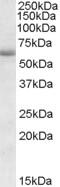 Transient Receptor Potential Cation Channel Subfamily C Member 6 antibody, 42-754, ProSci, Western Blot image 