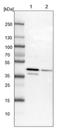 Ubiquitin Like Domain Containing CTD Phosphatase 1 antibody, NBP1-85468, Novus Biologicals, Western Blot image 