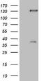 Sterol Regulatory Element Binding Transcription Factor 2 antibody, LS-C790898, Lifespan Biosciences, Western Blot image 