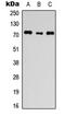 Anoctamin 1 antibody, LS-C354535, Lifespan Biosciences, Western Blot image 