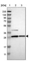 Alpha-2-Glycoprotein 1, Zinc-Binding antibody, PA5-52951, Invitrogen Antibodies, Western Blot image 
