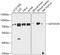 Transcriptional repressor p66-beta antibody, GTX66580, GeneTex, Western Blot image 