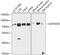 GATA Zinc Finger Domain Containing 2B antibody, GTX66580, GeneTex, Western Blot image 