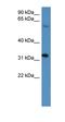 Homeobox D13 antibody, orb329631, Biorbyt, Western Blot image 
