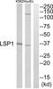 Lymphocyte-specific protein 1 antibody, abx014564, Abbexa, Western Blot image 