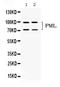 Promyelocytic Leukemia antibody, PB10084, Boster Biological Technology, Western Blot image 