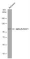 Alpha-actinin-1 antibody, NBP1-32578, Novus Biologicals, Western Blot image 