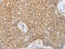 Serpin Family E Member 2 antibody, CSB-PA250447, Cusabio, Immunohistochemistry paraffin image 