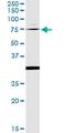 Oxidative Stress Responsive Kinase 1 antibody, MA5-20867, Invitrogen Antibodies, Immunoprecipitation image 