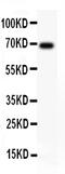 Alpha Fetoprotein antibody, PB9090, Boster Biological Technology, Western Blot image 