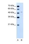 Ferrochelatase antibody, NBP1-54863, Novus Biologicals, Western Blot image 
