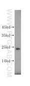 Calcyphosine Like antibody, 17174-1-AP, Proteintech Group, Western Blot image 