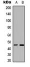 Beta-1,4-Galactosyltransferase 6 antibody, orb234768, Biorbyt, Western Blot image 