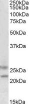 F-Box Protein 44 antibody, NBP1-51915, Novus Biologicals, Western Blot image 