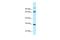 Proline Rich Transmembrane Protein 1 antibody, A13564, Boster Biological Technology, Western Blot image 