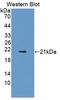 Adiponectin Receptor 2 antibody, LS-C372465, Lifespan Biosciences, Western Blot image 