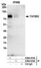 Transforming Growth Factor Beta Receptor 2 antibody, A304-413A, Bethyl Labs, Immunoprecipitation image 