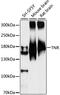 Tenascin R antibody, LS-C750294, Lifespan Biosciences, Western Blot image 