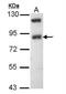 Sodium Channel Epithelial 1 Beta Subunit antibody, NBP1-33097, Novus Biologicals, Western Blot image 