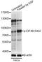 Eukaryotic Translation Initiation Factor 4B antibody, LS-C750580, Lifespan Biosciences, Western Blot image 