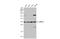 Actin Related Protein 2/3 Complex Subunit 2 antibody, GTX101984, GeneTex, Western Blot image 