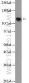 NOP2 Nucleolar Protein antibody, 10448-1-AP, Proteintech Group, Western Blot image 