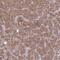 TBC1 Domain Family Member 4 antibody, NBP2-38880, Novus Biologicals, Immunohistochemistry paraffin image 