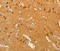Solute Carrier Family 18 Member A2 antibody, A02232, Boster Biological Technology, Immunohistochemistry frozen image 
